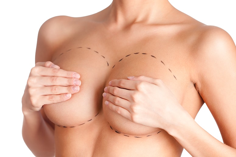 Prise en charge de l'augmentation mammaire | Dr Sarfati