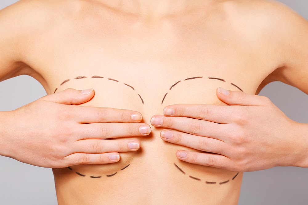 Qui aller voir pour une réduction mammaire ? | Dr Sarfati