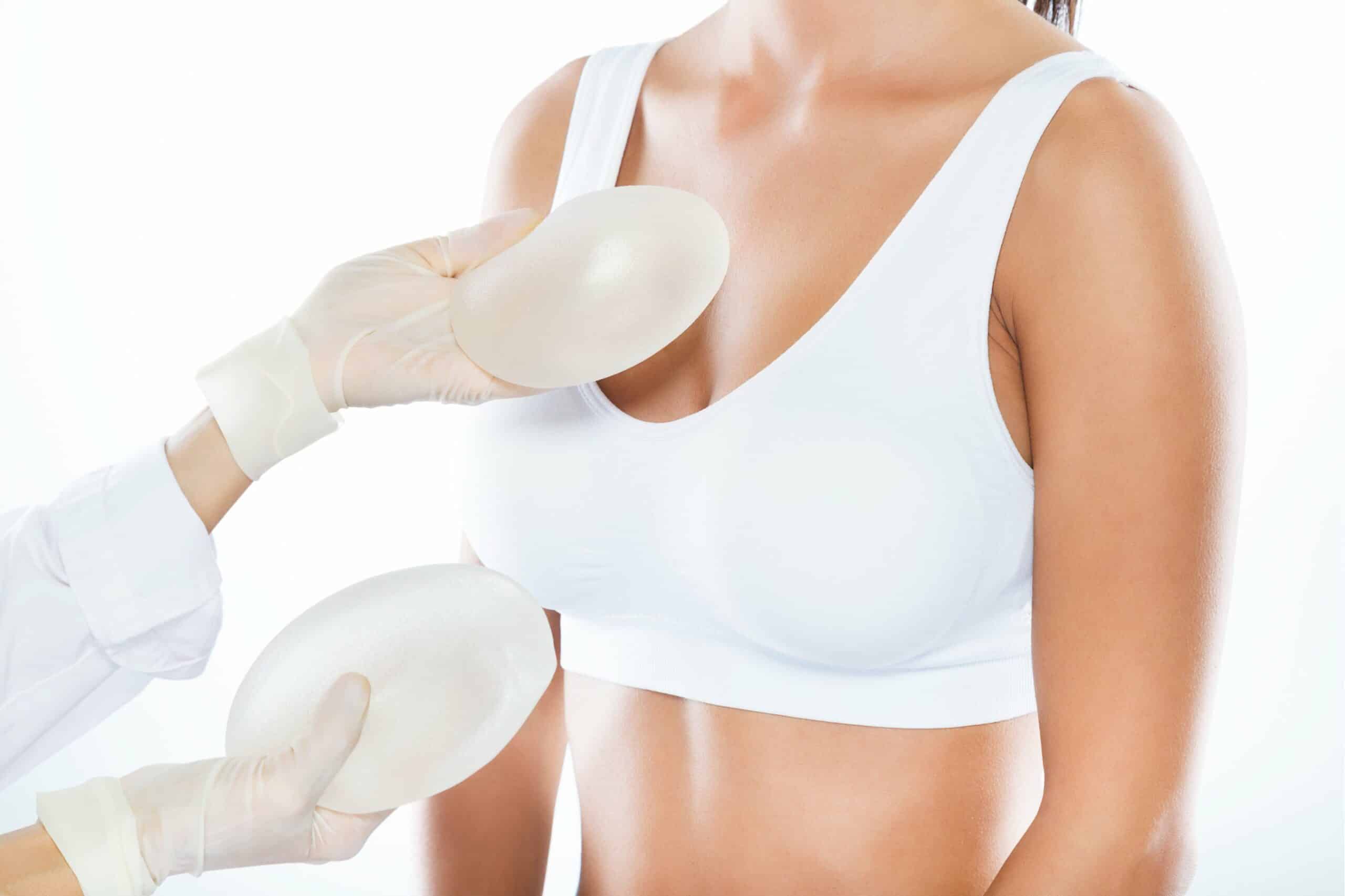 Augmentation mammaire avec implant à Paris | Dr B. Sarfati