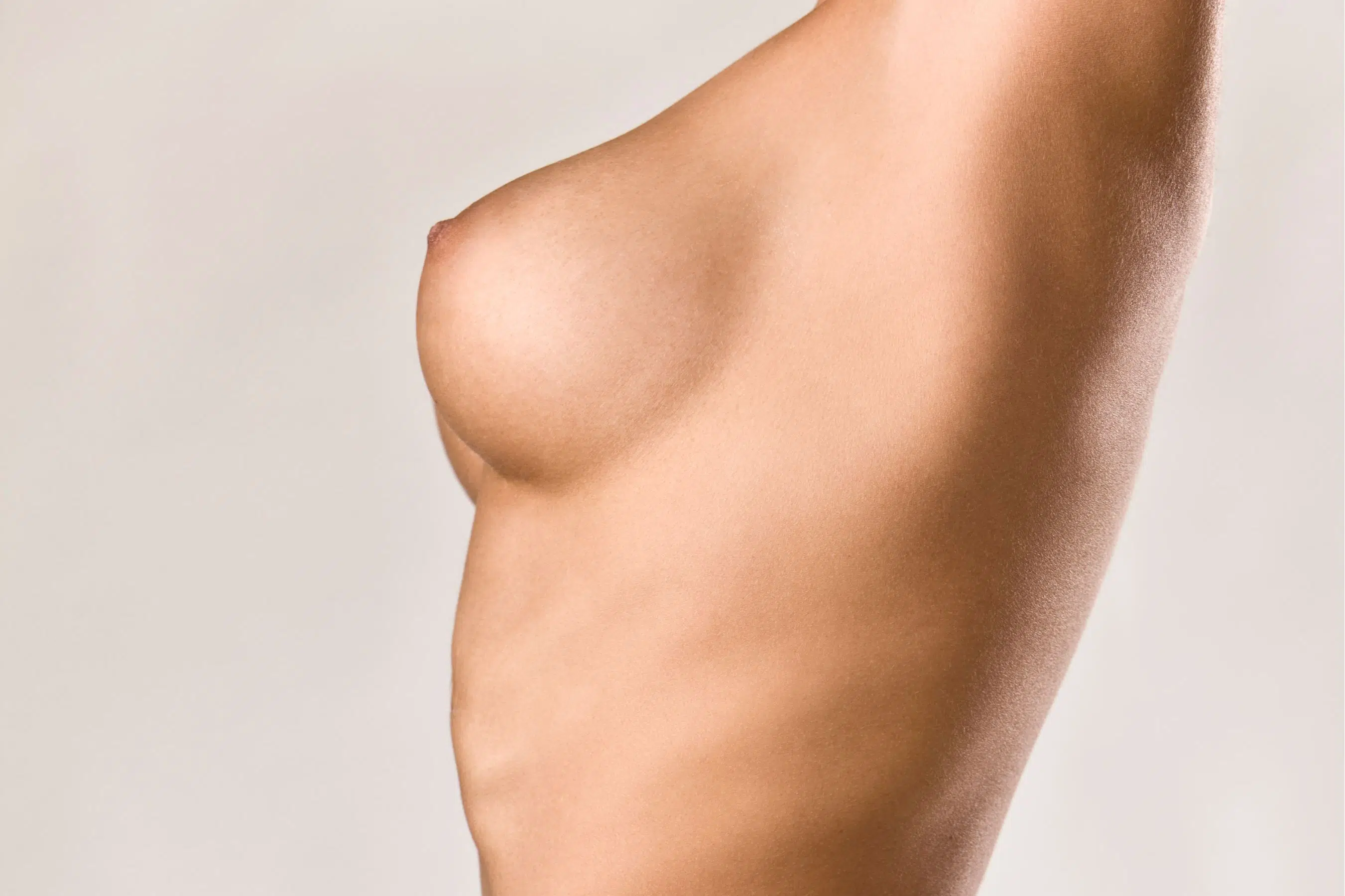 Reconstruction mammaire (grand dorsal) à Paris | Dr B. Sarfati