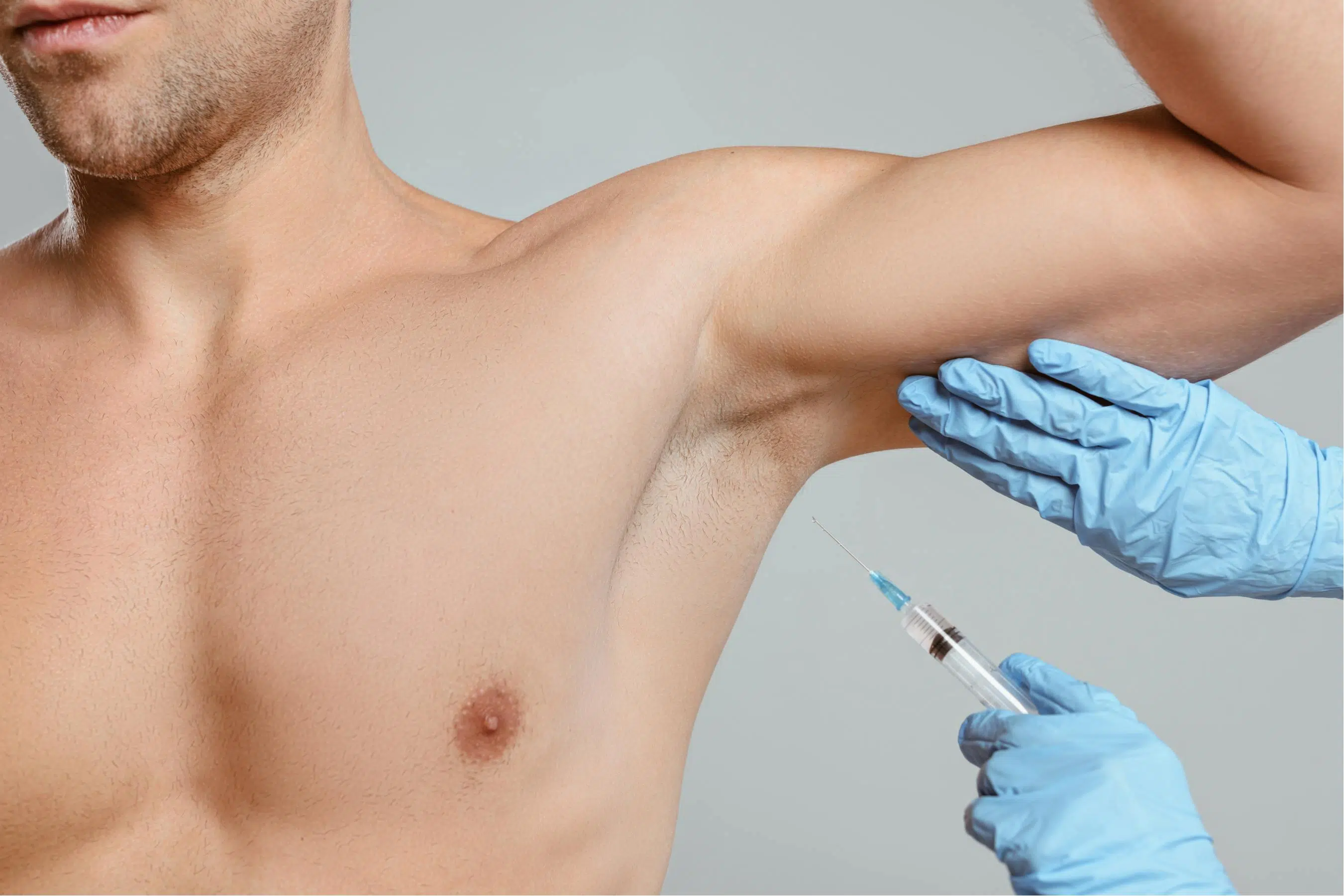 Traitement de la transpiration excessive à Paris | Dr B. Sarfati