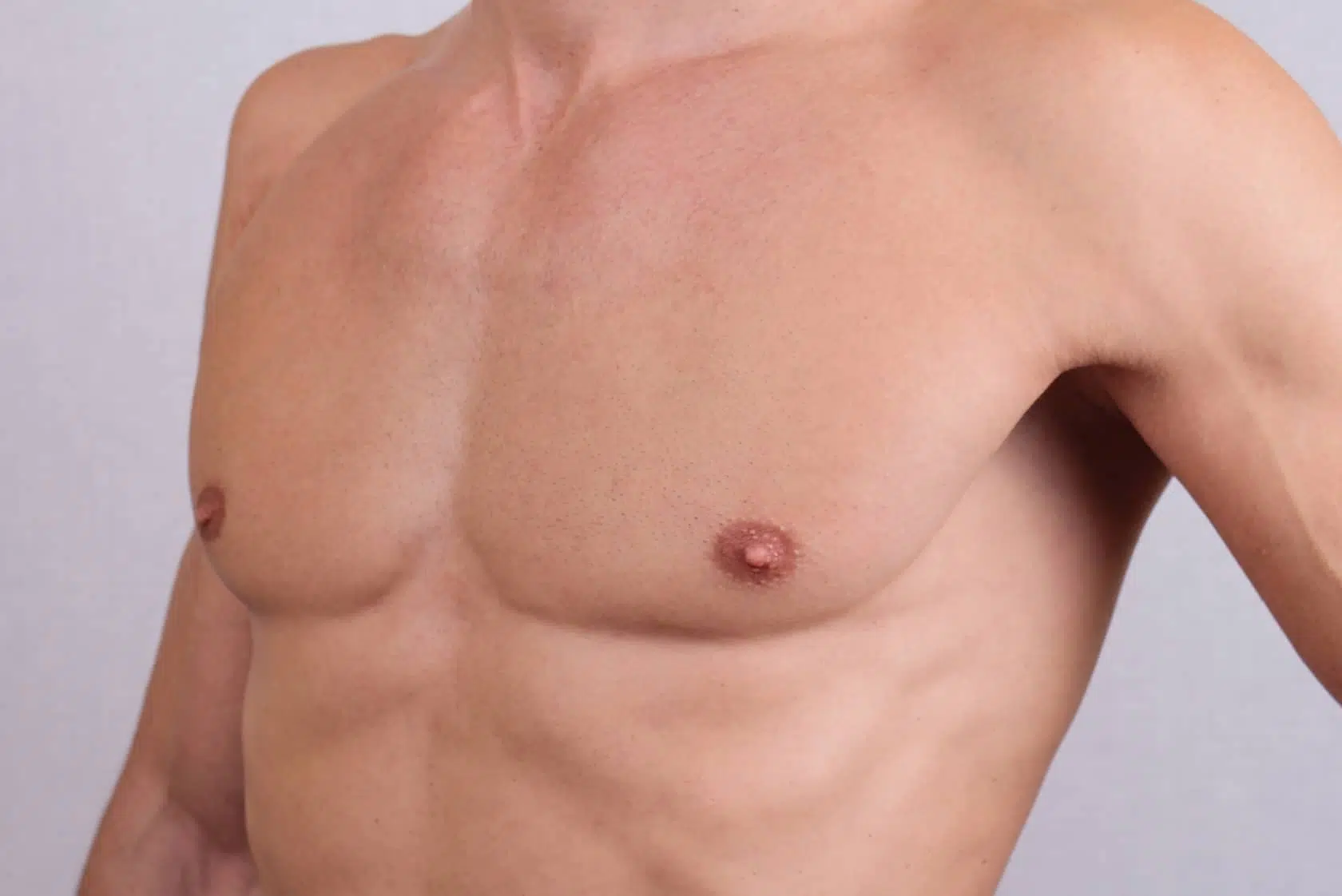 Homme avec Torse nu quelle convalescence apres une chirurgie de correction de gynecomastie Dr Benjamin Sarfati paris