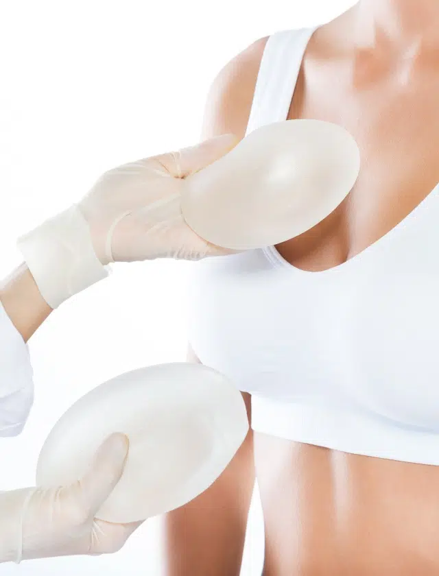 Vignette augmentation mammaire avec implant | Dr Sarfati | Paris