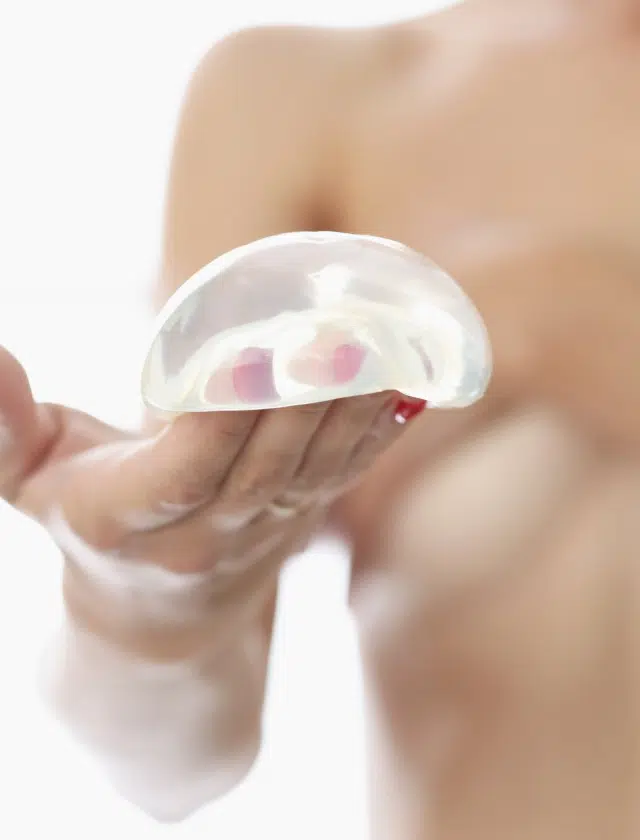 Vignette chirurgie plastique par prothèse | Dr Sarfati | Paris