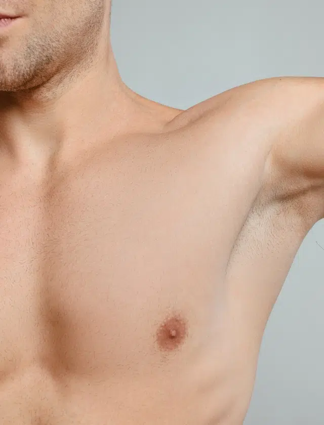 Un homme prends une injection de botox pour traitement de transpiration excessive Dr Benjamin Sarfati paris