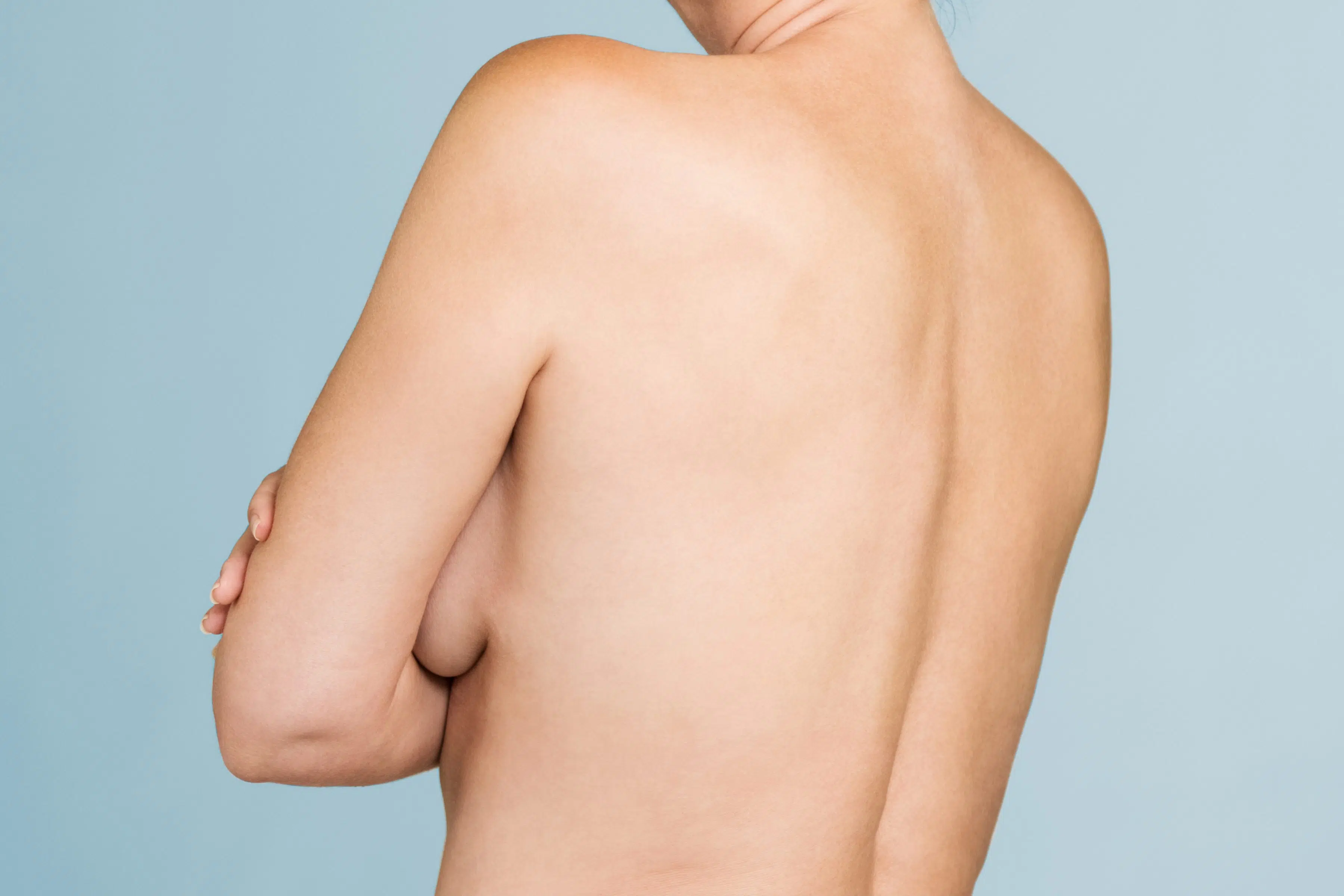 Supernumerary nipples | Dr. Benjamin Sarfati | Paris