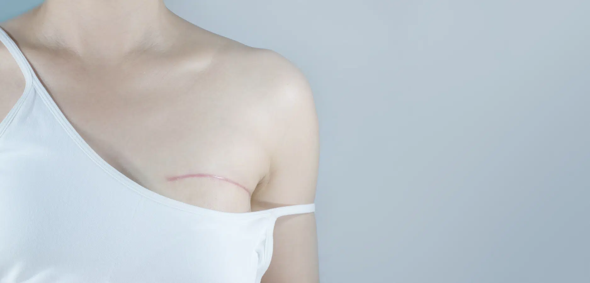 Reconstruction mammaire post cancer du sein | Dr Sarfati | Paris