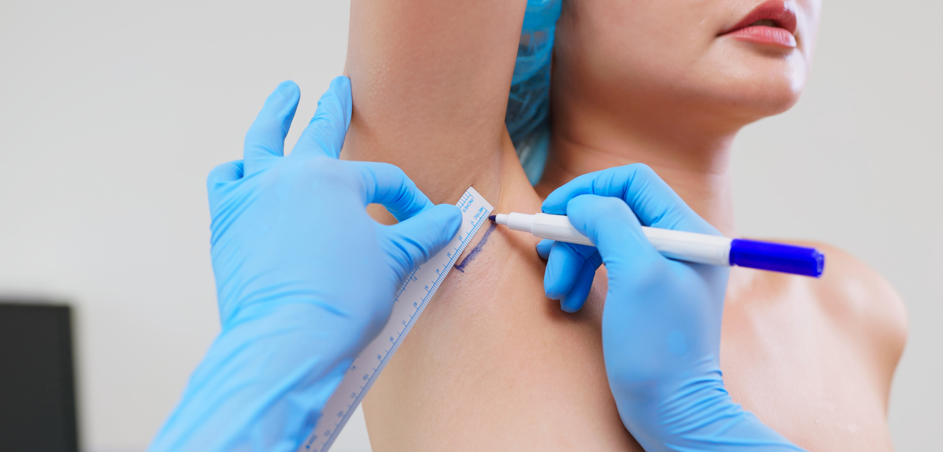 Augmentation Preservé | Dr Sarfati | Paris