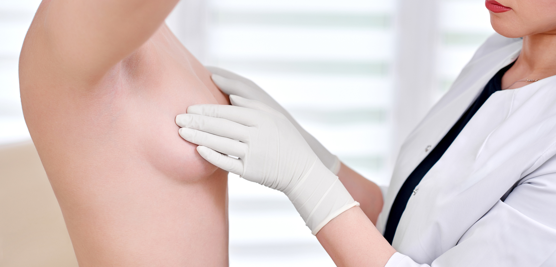 rôle consultation préopératoire choix implants mammaires | Dr Sarfati | Paris