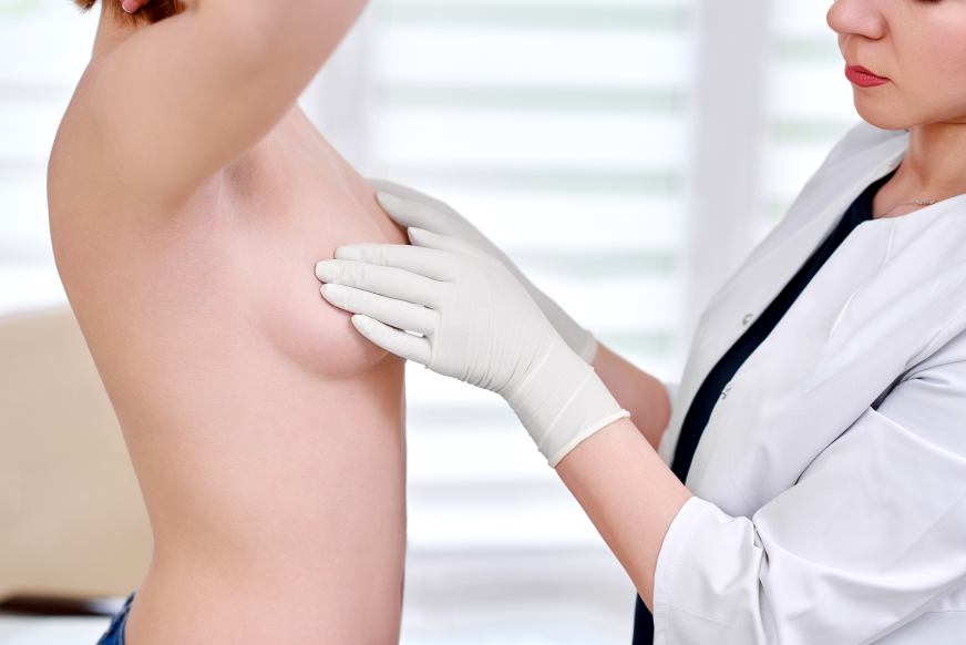 rôle consultation préopératoire choix implants mammaires | Dr Sarfati | Paris