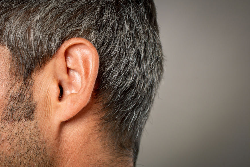 Comment déroule chirurgie réduction pavillon oreille | Dr Sarfati | Paris