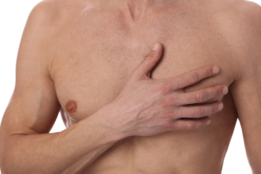 Risques complications possibles après chirurgie gynécomastie | Dr Sarfati | Paris